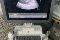 Samsung Medison SonoAce R5