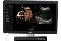 Samsung Medison Ugeo RS80А Prestige