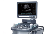 Siemens Acuson Х600
